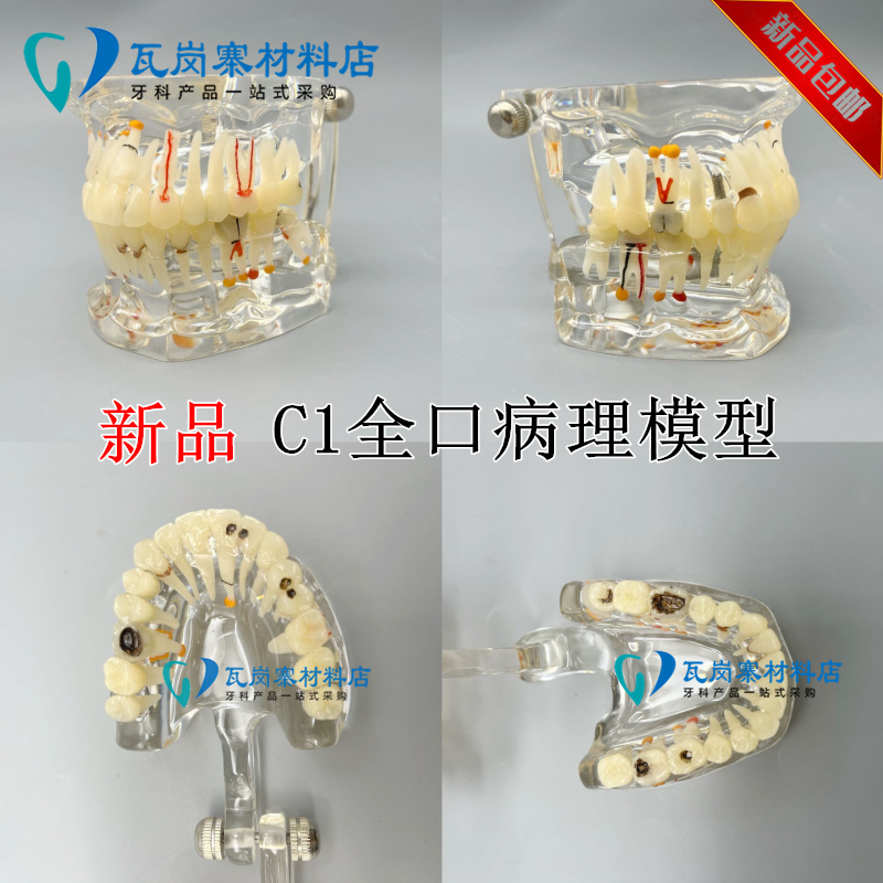 牙科口腔教学 成人病理模型 水晶透明 全口32颗牙齿 医患沟通包邮