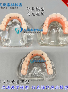 牙科口腔模型马龙连桥义齿修复种植牙齿仿真演示模拟教学医患沟通