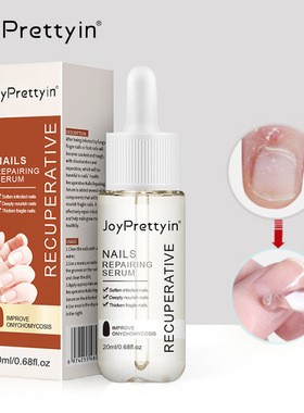 Gray nail polish, uneven thick nail, soft nail repair, finge