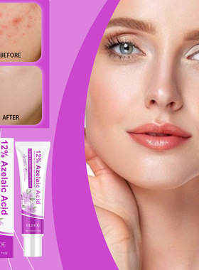 Azelaic acid acne care cream lightens acne improves redness