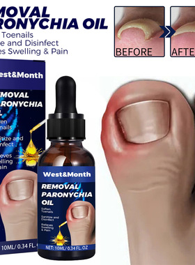 Nail care oil hand foot ingrown toenails soft armor moisturi