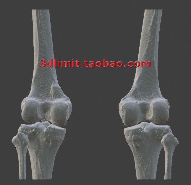 3D打印扫描DICOM dcm CT医学数据转换3D模型stl obj gltf dae fbx图片