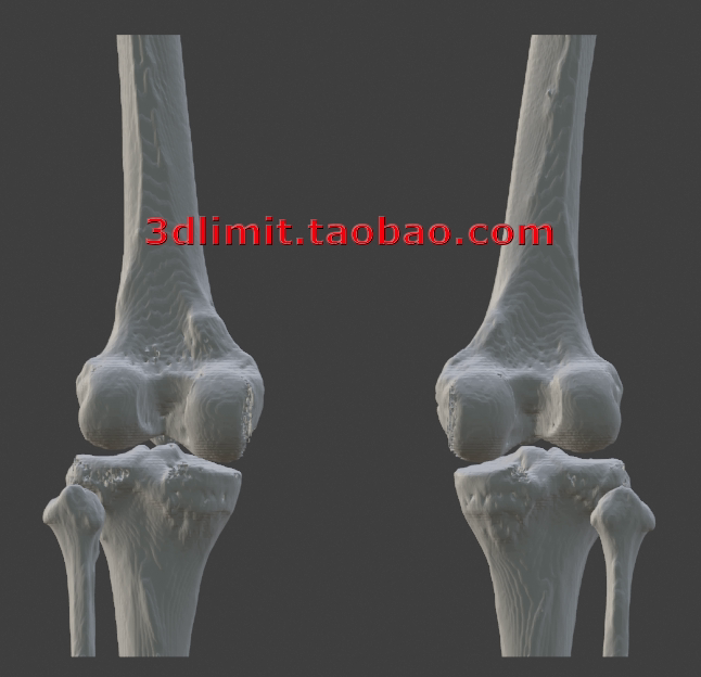 3D打印扫描DICOM dcm CT医学数据转换3D模型stl obj gltf dae fbx 商务/设计服务 设计素材/源文件 原图主图