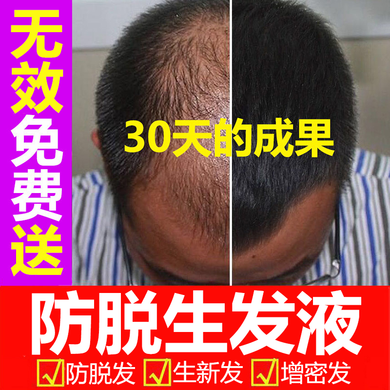 防脱发育发液生发剂快速生长增发密发焕活毛囊增长精华男女士专用