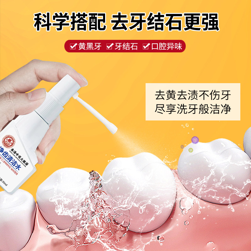 牙结石溶解喷雾牙渍污垢黄牙齿口臭神器速清理效非医用美白去清除