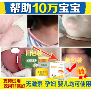 【买1送1发2盒】一抹灵儿童装正品皮肤止痒湿痒宝宝孕妇小孩儿童