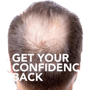 印度代购密发神器印度保  男女发髻线