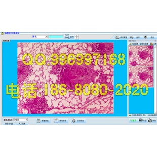 病理工作站软件病理图文报告软件病理报告软件win7/win10