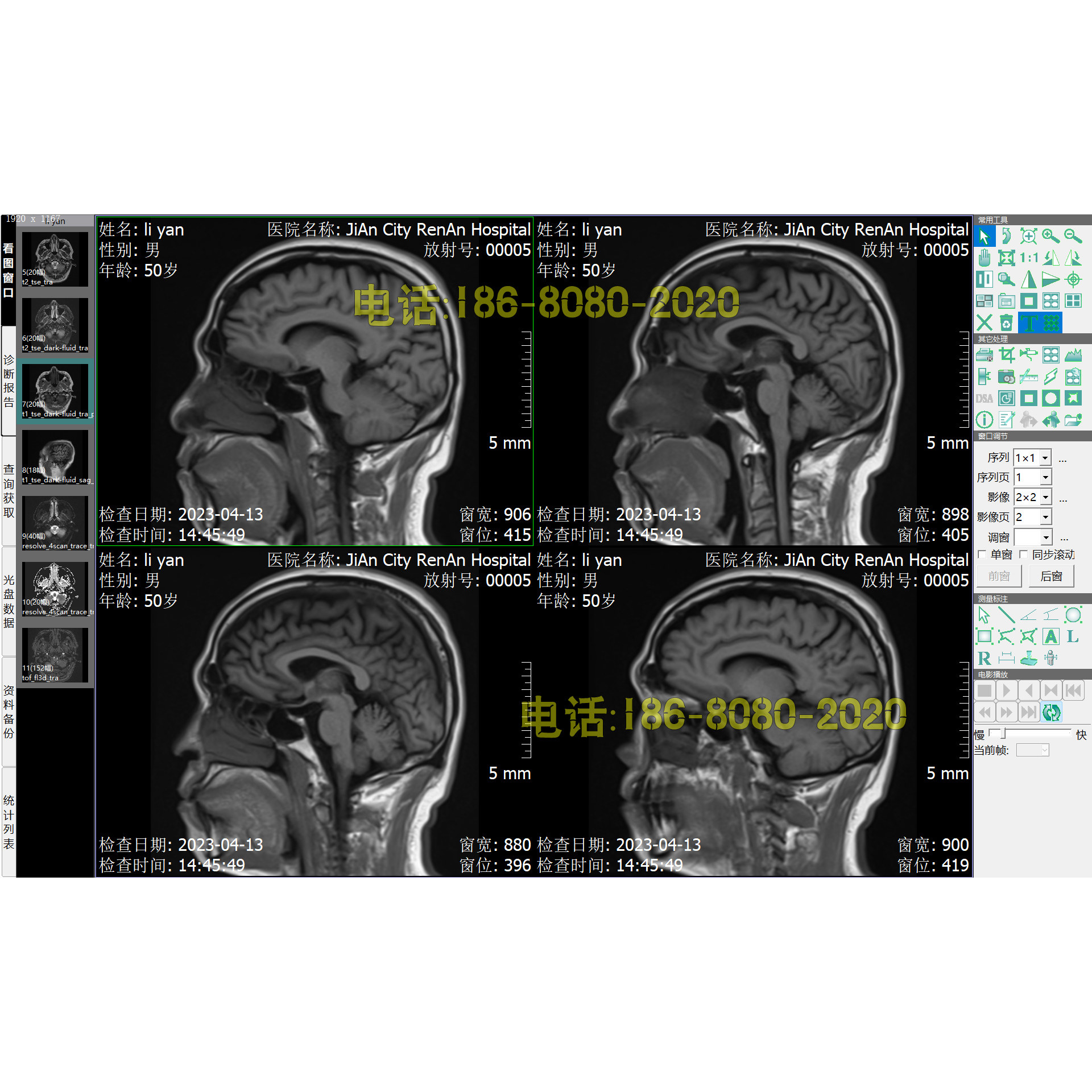 CT工作站软件X光机CR软件DR工作站MRI核磁DSA软件PACS软件加密锁