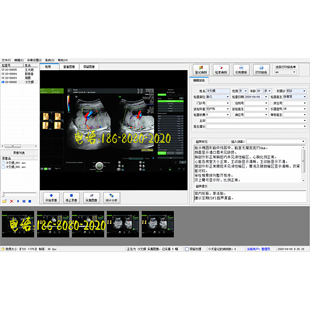 淳仁超声高清软件彩超工作站胃肠镜宫腹腔镜耳鼻喉镜内镜软件全套
