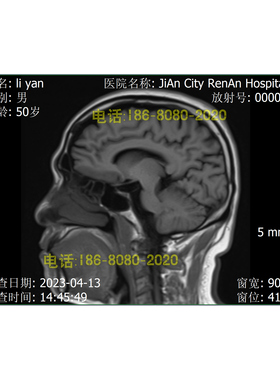 CT工作站软件 X光机 CR软件 DR工作站MRI核磁软件DSA软件PACS软件