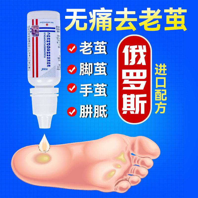 去脚茧脚垫死皮液体软化剂去厚茧子厚皮手茧神器无痛剥离自然脱落