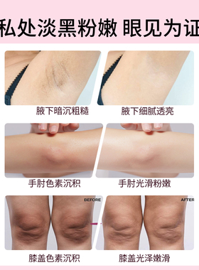 Cumlaude lab珂蔓朵 私处粉嫩焕活凝霜淡化黑色素花园粉嫩精华