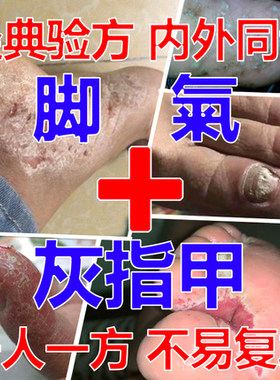 严重专用