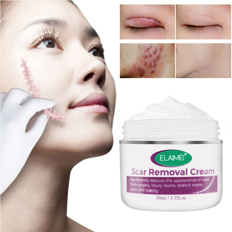 疤痕霜淡化娠纹烫伤祛除膏手术