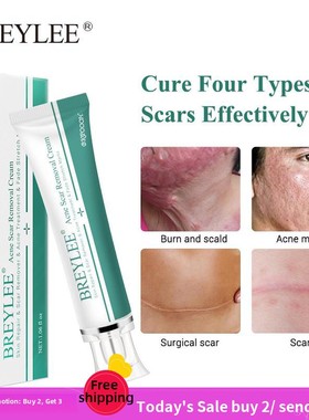 BREYLEE Remove scars Pregnant woman Stretch marks Care cream
