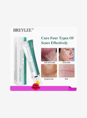 Acne Scar Removal Cream Face Repair Skin Whitening cream30g