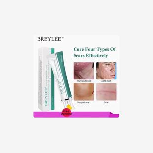 Acne Scar Removal Cream Face Repair Skin Whitening cream30g