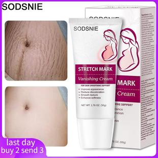 Cream Vanishing Repair Anti Aging Stretch Wrinkle Mark