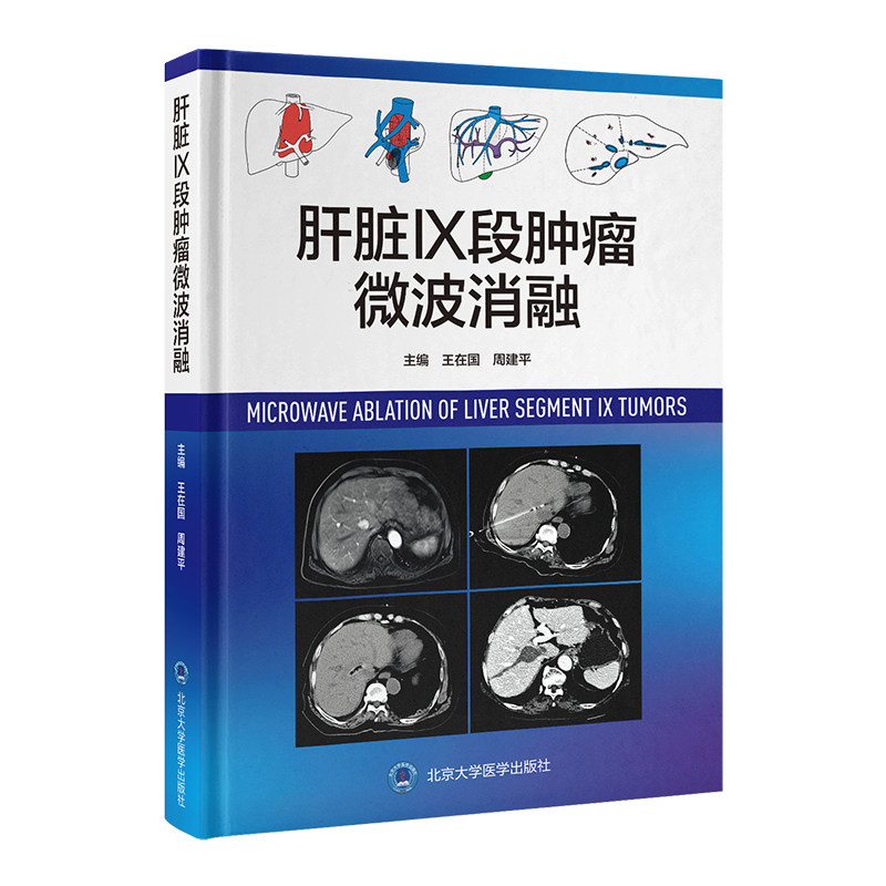 肝脏IX段肿瘤微波消融 王在国 周建平 肝脏肿瘤导管消融术微波技术正版书籍 北京大学医学出版社9787565931093