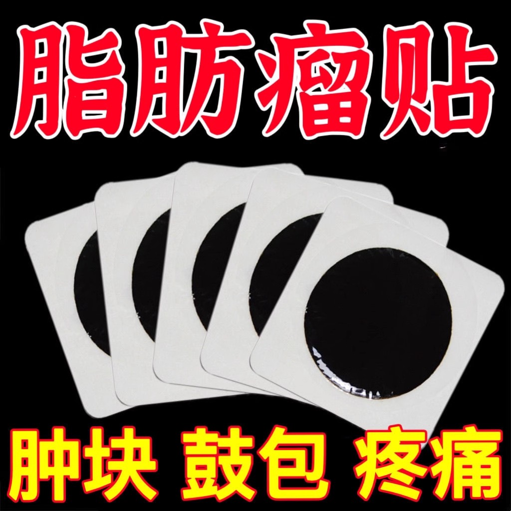 脂肪瘤一贴灵专消皮下肿块硬块单发性多发性脂肪瘤去粉瘤囊肿药贴