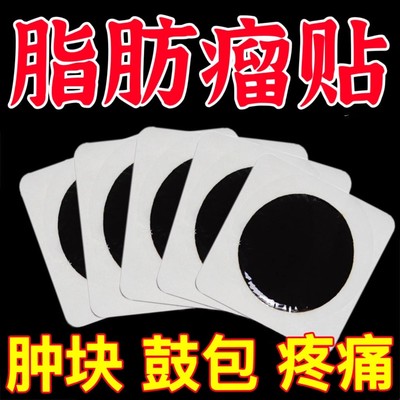 脂肪瘤一贴灵专消皮下肿块硬块单发性多发性脂肪瘤去粉瘤囊肿药贴