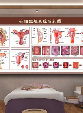 女性生殖系统解剖图海报装饰大挂图关爱女性健康海报妇科炎症宣传
