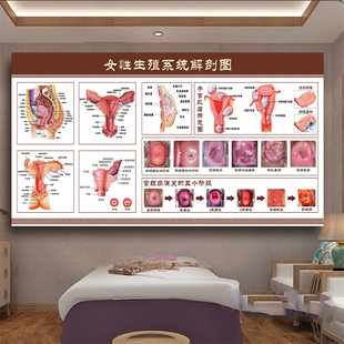 女性生殖系统解剖图海报装饰大挂图关爱女性健康海报妇科炎症宣传