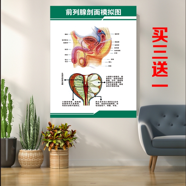 前列腺正中剖面解剖图男性生殖系统海报宣传挂图挂画贴报贴画