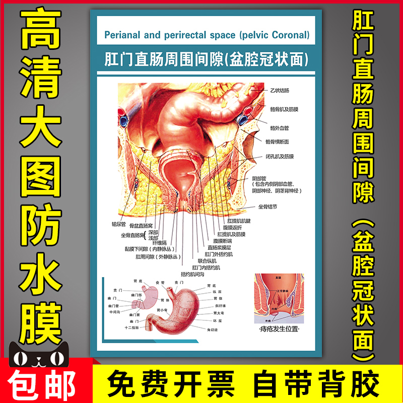 肛门直肠周围间隙盆腔冠状面医院医学知识挂画解剖图痔疮发生位置