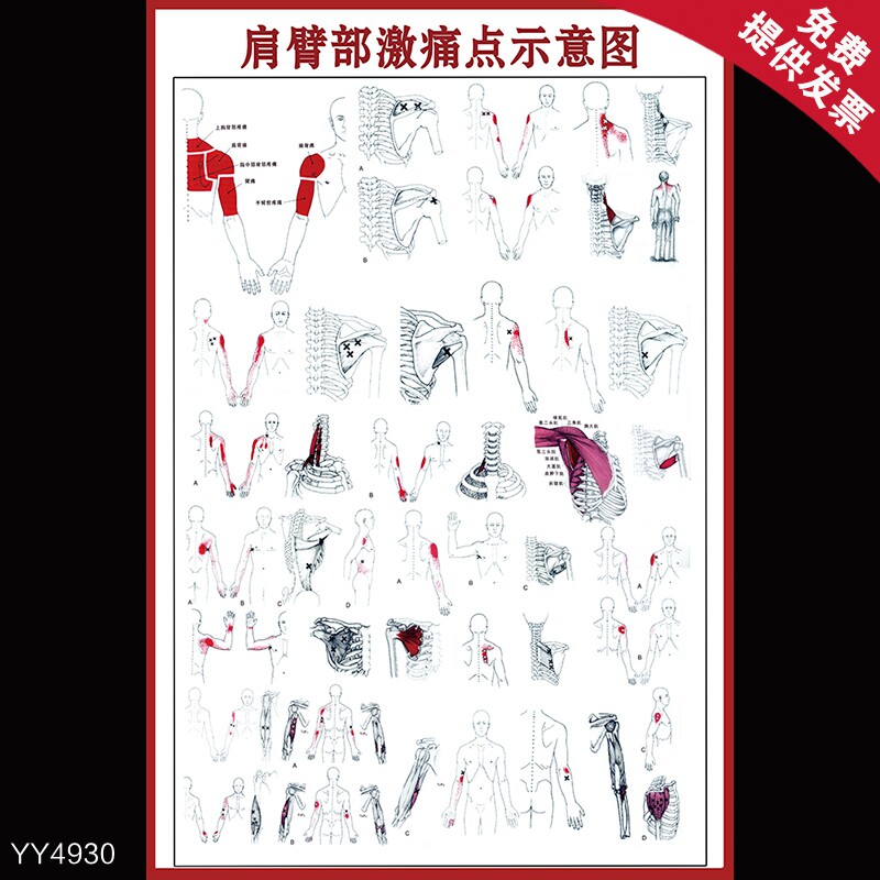 肩臂部激痛点示意图挂图 前臂和手部激痛点示意图海报 医院墙贴画