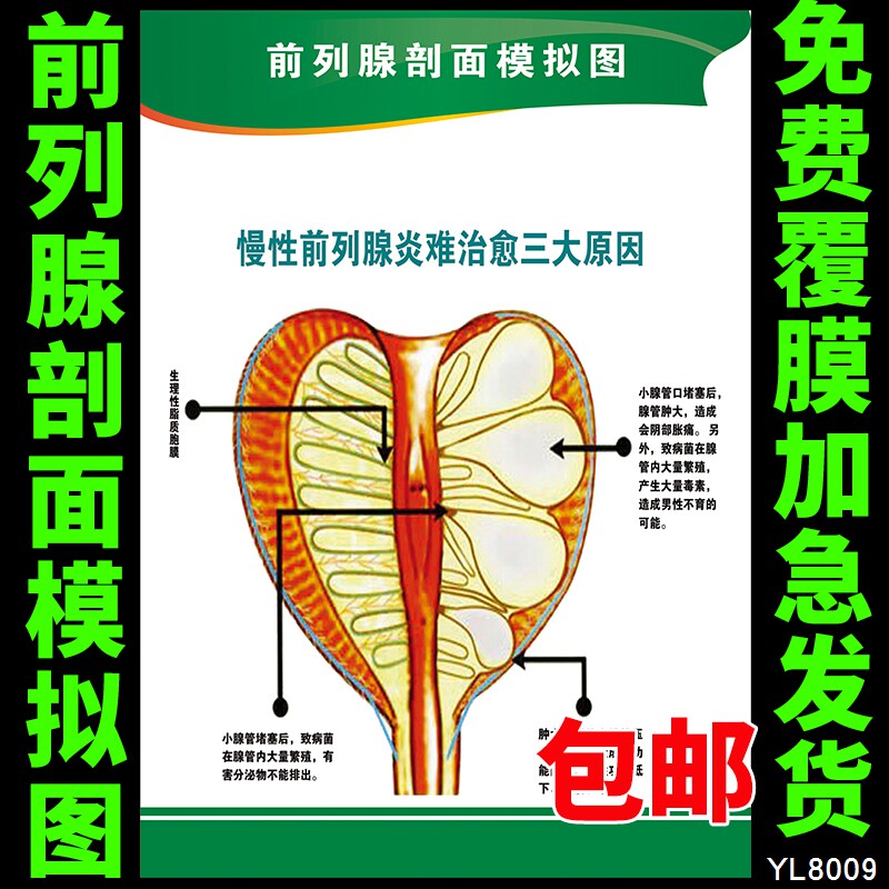 医院文化挂图 男性前列腺剖面模拟图 人体解剖知识宣传画海报制作