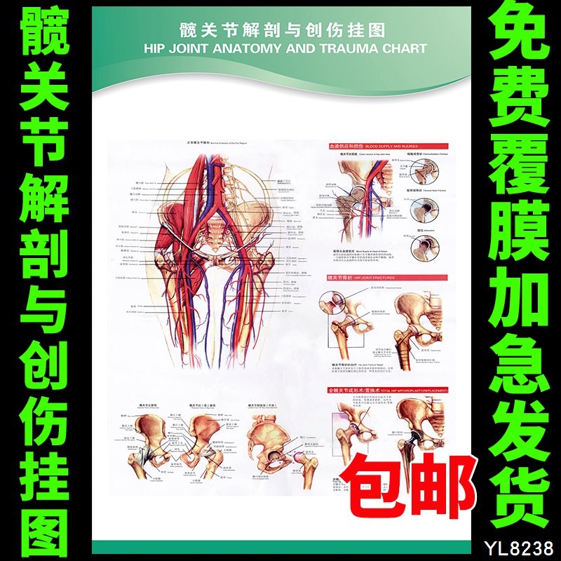 医院装饰墙贴画 髋关节解剖与创伤挂图 医学知识宣传海报