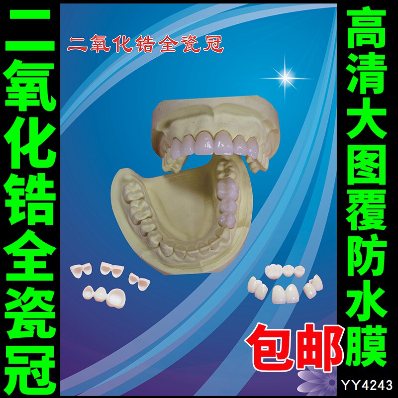 二氧化锆全瓷冠宣传海报 医院牙科烤瓷牙知识挂图 口腔保健宣传画