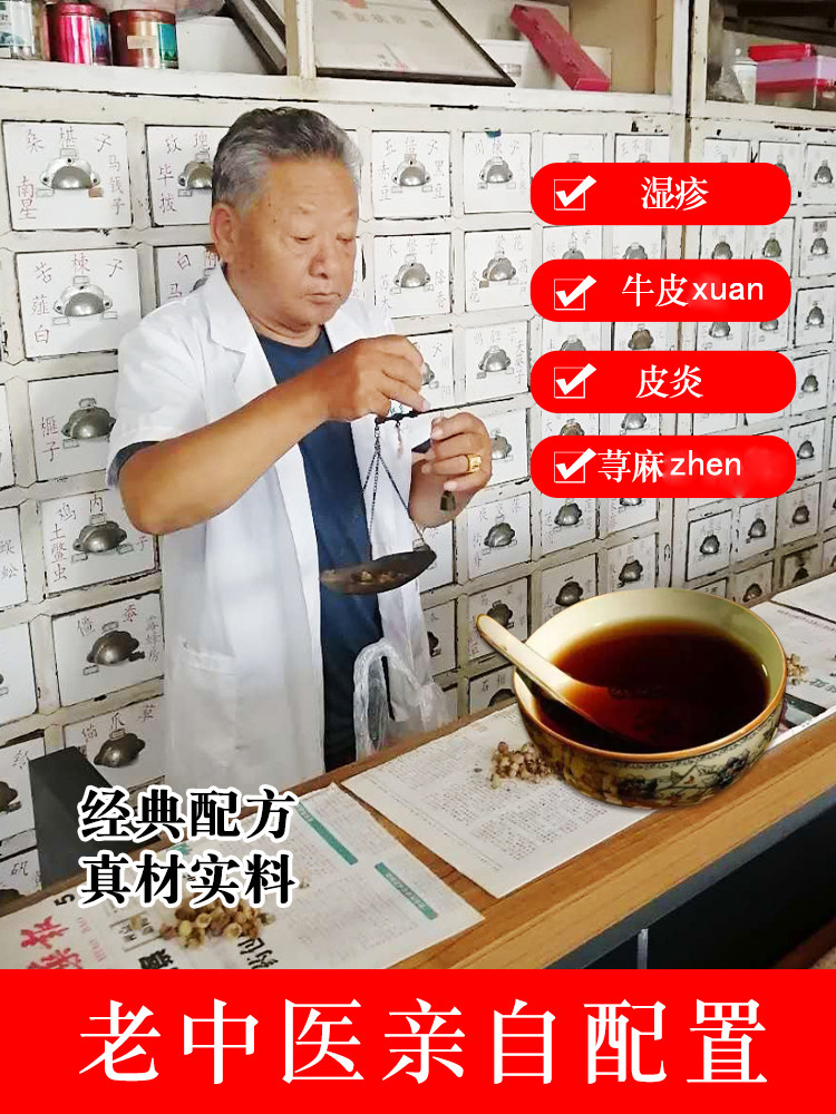 祛湿热养生茶荨麻疹湿疹寒热性胆碱性寻麻疹皮肤划痕止痒中药汤剂,医疗器械,保健理疗,淘宝优惠券,粉丝福利购,淘宝优惠卷
