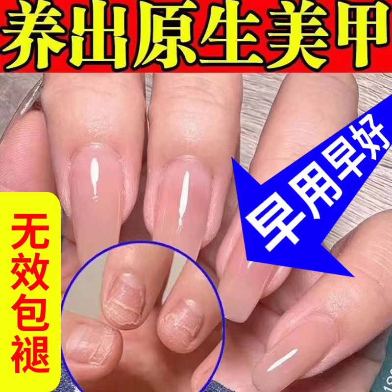 治手脚脚趾甲空甲分离修复灰指甲