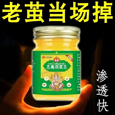 香港去老茧脚茧关节茧手茧子脚底老茧专用脚垫脚趾厚茧去除软化膏