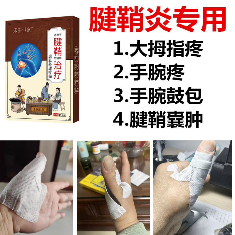 腱鞘炎专用膏药贴免费试用3贴