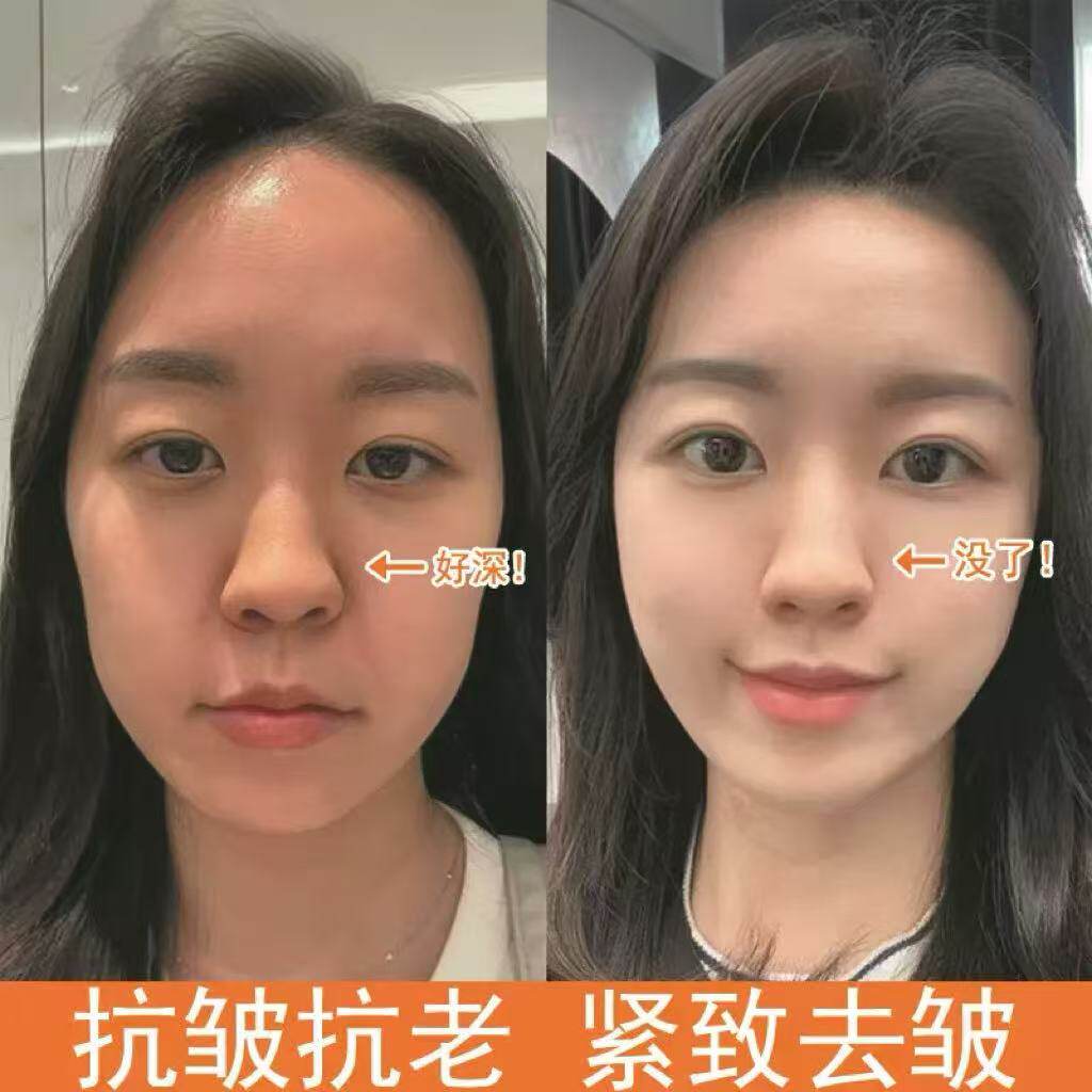 液态超叨叨精华油 多维悬吊 3D立体塑颜抗皱巨提拉 眼周面部可用
