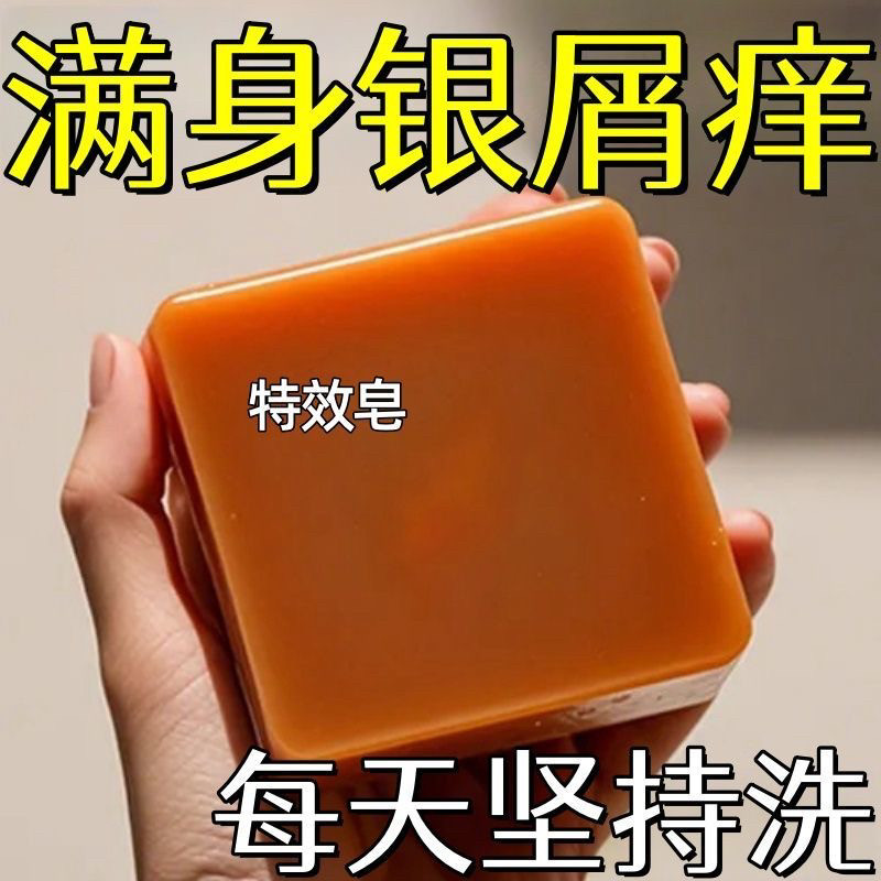 【洗完不再痒】牛皮癣皂头皮股银去屑病皮肤止痒杀菌肤康藓皂正品
