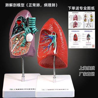 人体自然大肺解剖模型 肺部展示教学 肺结核肺结节医学病理肺模型