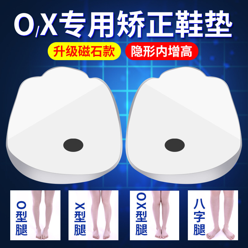 腿不直鞋垫足内翻x型xo纠正器内外八字儿童直腿型神器小腿外翻