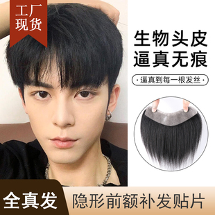 发际线假发贴片无痕隐形男士生物头皮鬓角前额头刘海M型假发片