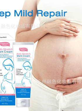 严选跨境身体乳肚纹霜清爽不油腻滋润去生长纹Stretch mark cream