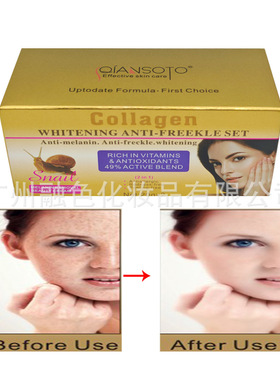 跨境英俄文QIANSOTO蜗牛早晚霜透亮减弱脸部色素面霜frecklecream