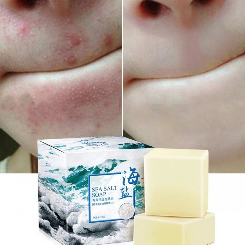 海盐除螨羊奶皂洁面手工皂儿童祛痘控油正品香皂除螨虫洗脸皂男女