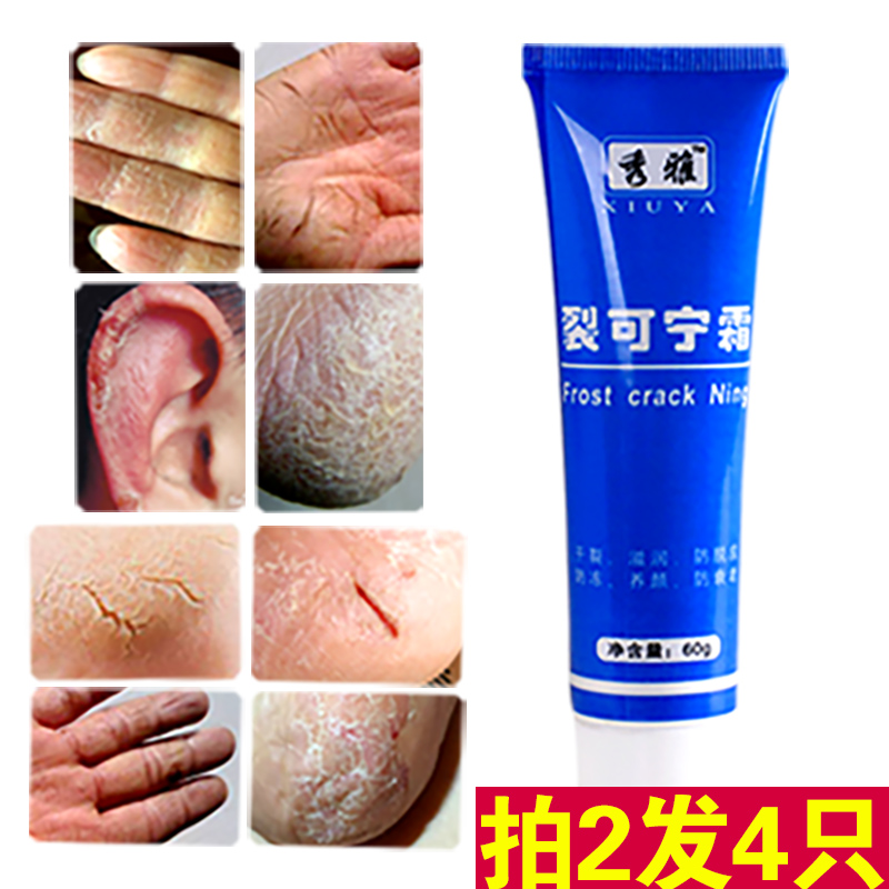 防裂膏手足干裂 裂可宁霜脚后跟干裂开裂滋润保湿护手霜龟裂特效