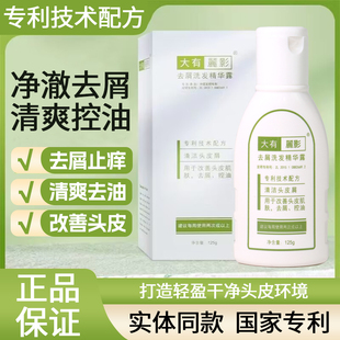 正品大有丽影去屑洗发水 丽影洗发精华除螨虫强力去大块头屑神器