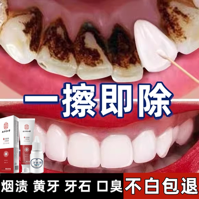 牙膏美白去黄去口臭男士专用强力去烟渍牙齿垢牙结石去除神器溶解
