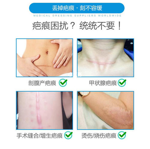 台湾疤痕贴剖腹产恢复愈合贴疤痕增生贴产后修复套装